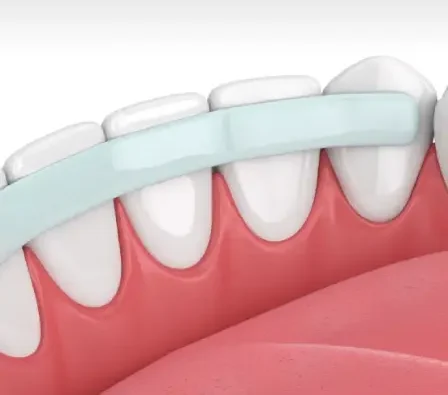 Replace One Missing Tooth With a Permanent Solution