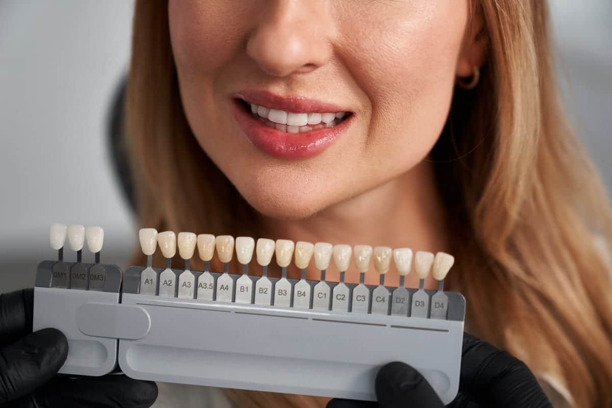 Veneers in Harper Woods