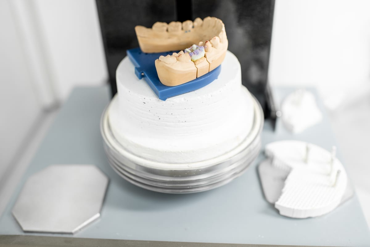 Dental Crowns in Harper Woods